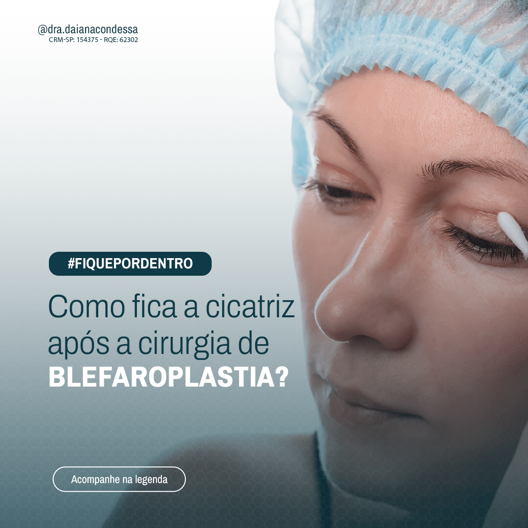 Cicatriz blefaroplastia