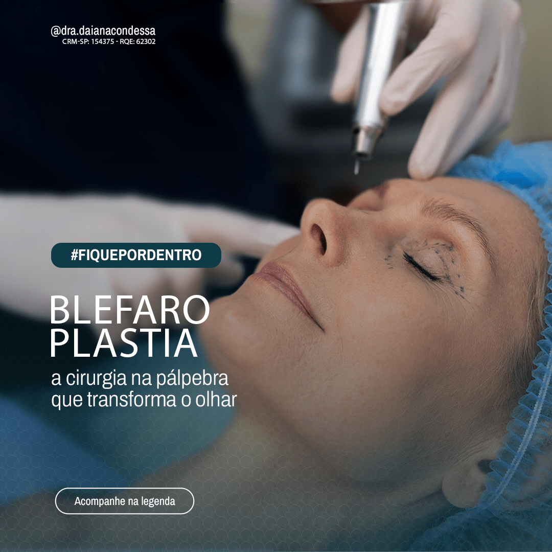 Cirurgia de blefaroplastia