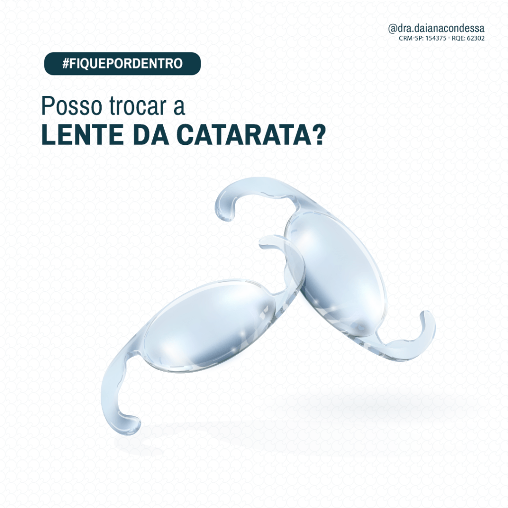Lente da catarata